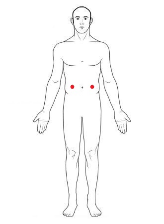 MicroGen TENS pads placement for ibs
