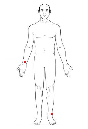Tens Pads Placement