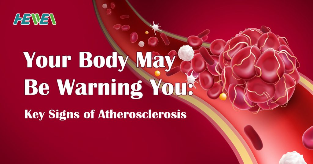 Signs of Atherosclerosis